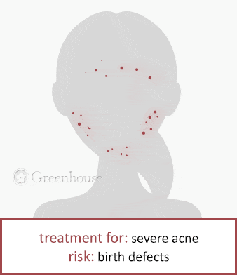 accutane effects
